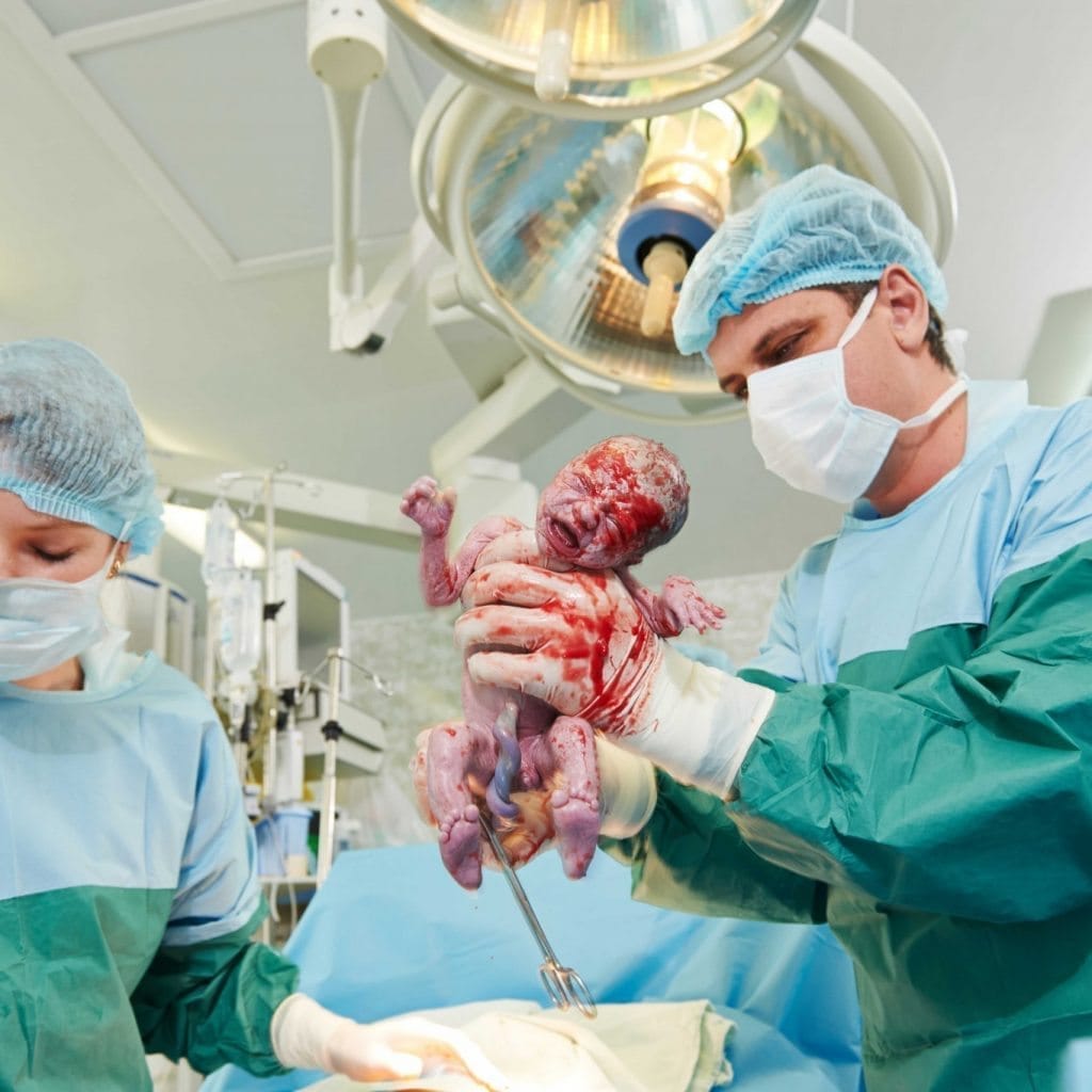 Caesarean delivery
