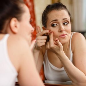 Pcos Polycystic Ovary Syndrome 2 Acne can affect women with pcos