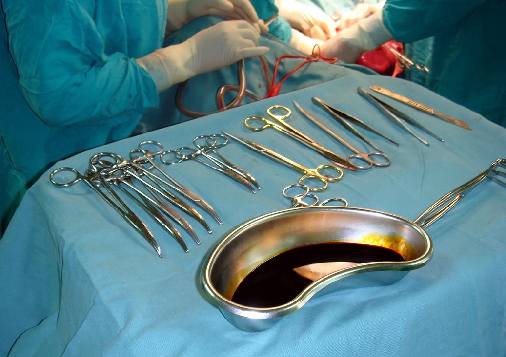 Gynaecological Surgery