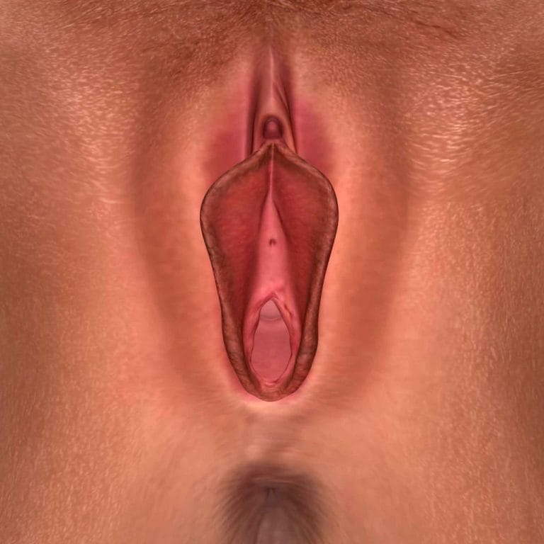 Painful Sex 5 Vulval pain