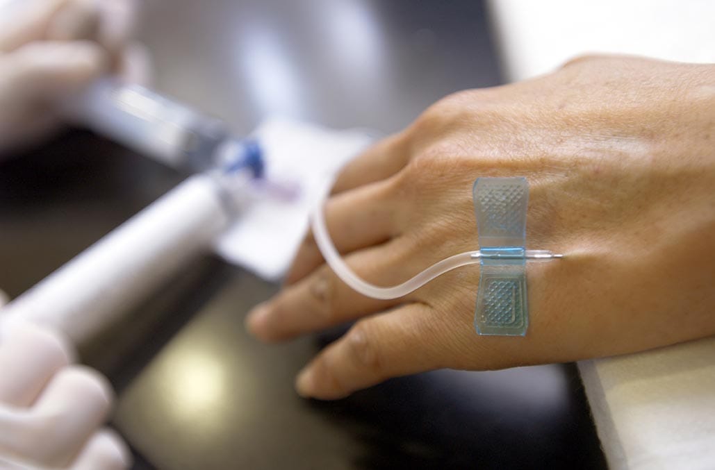 Non-Drug Pain Relief In Labour 2 Iv cannula in labour